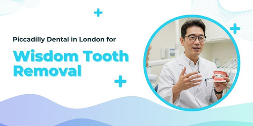 Piccadilly Dental in London for Wisdom Tooth Removal.jpg