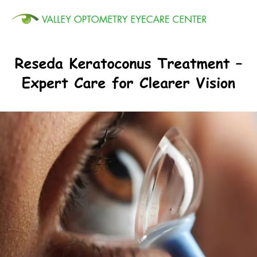 Reseda Keratoconus Treatment – Expert Care for Clearer Vision.jpg