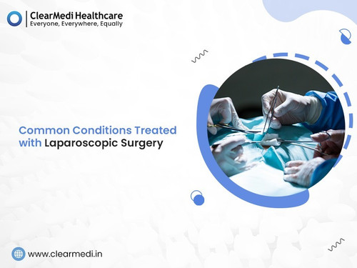 Common Conditions Treated with Laparoscopic Surgery.jpg