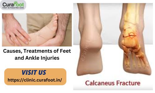 Causes & Treatments of Feet and Ankle Injuries.jpg