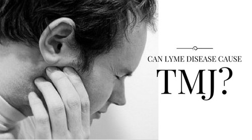 TMJ Botox NYC.jpg