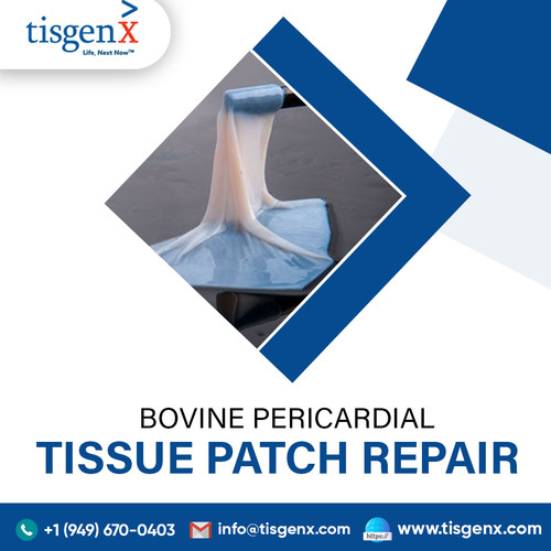 Bovine Pericardial Tissue Patch Repair.jpg