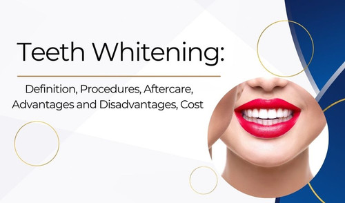 Teeth Whitening Definition, Procedures, Aftercare, Advantages and Disadvantages, Cost.jpg