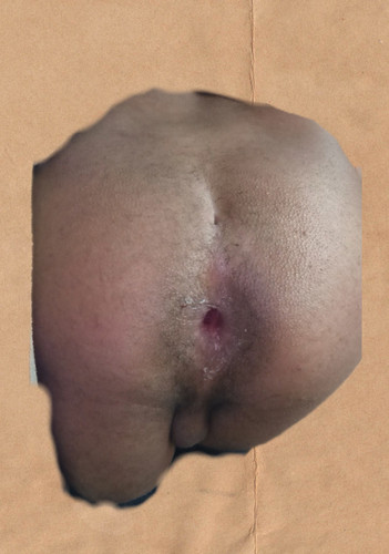 3I34Fj4.md.jpg
