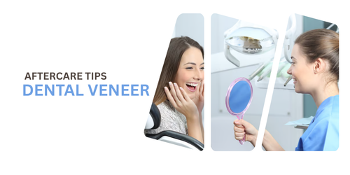 Dental Veneer Aftercare Tips Keep Your Smile Stunning.png