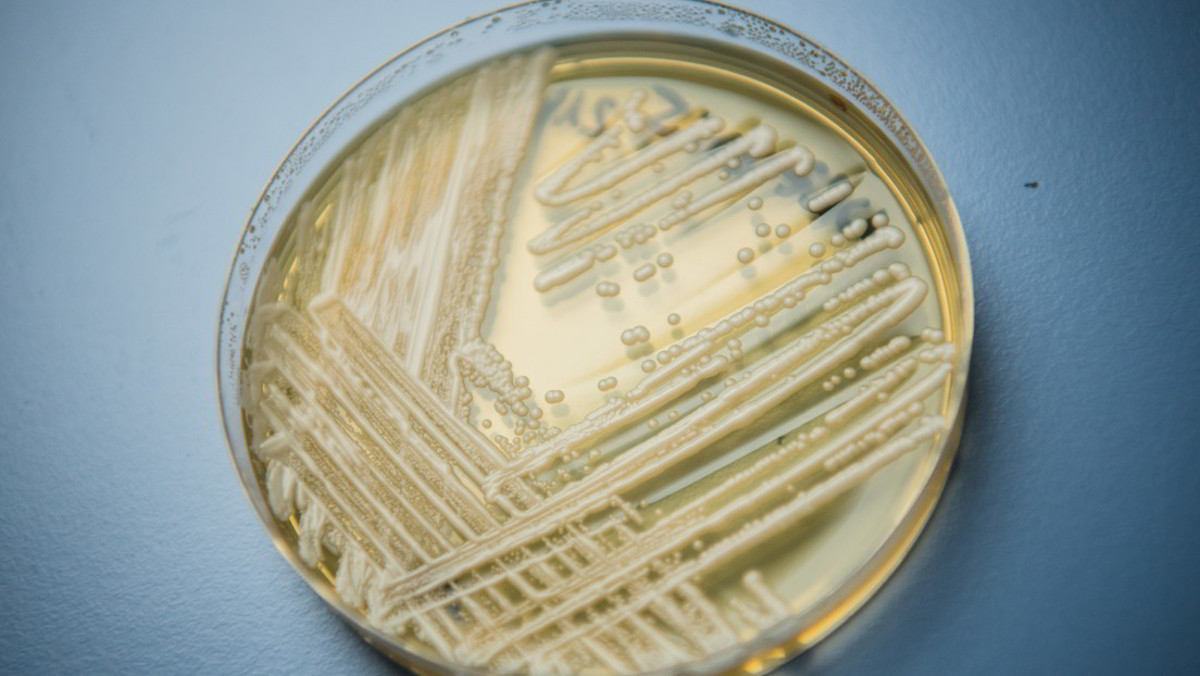 Candida auris, fungo mortale in forte diffusione negli USA