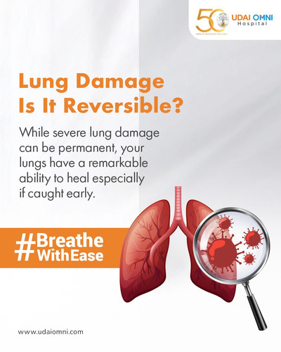 Best Pulmonology Hospitals in Hyderabad | Expert Lung Specialists.jpg