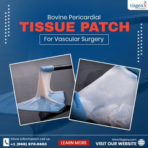 Bovine Pericardial Tissue Patch for Vascular Surgery.jpg