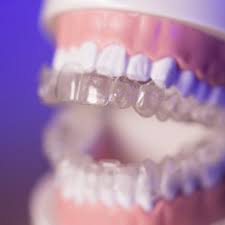 Invisalign Palo Alto.jpg