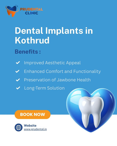 Dental Implants in Kothrud.jpg