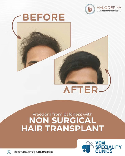 Best Skin and Hair Clinic in Hyderabad Madhapur.jpg