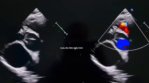 kXEdJ4jDmKnenPCh.jpg
