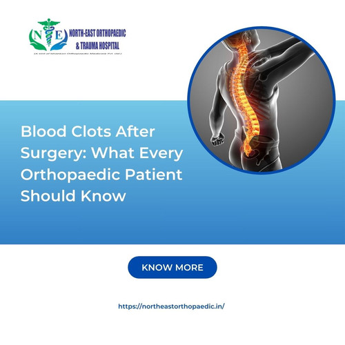 Blood Clots After Surgery: What Every Orthopaedic Patient Should Know.jpg