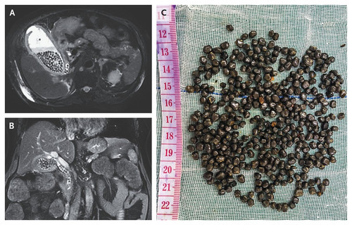 GqWfubGbMAAChnQ.jpg