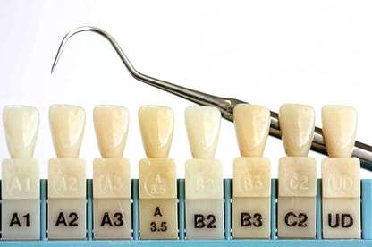 San Diego Dentist CA.jpg