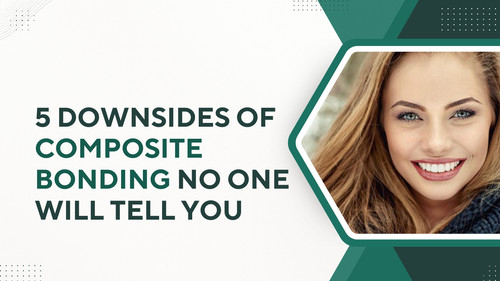 5 Downsides of Composite Bonding No One Will Tell You.jpg