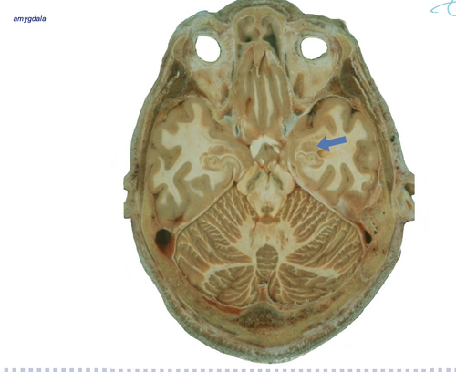 5cb1055cdc45.png