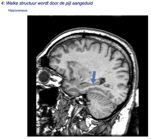 6cd62968967a.png