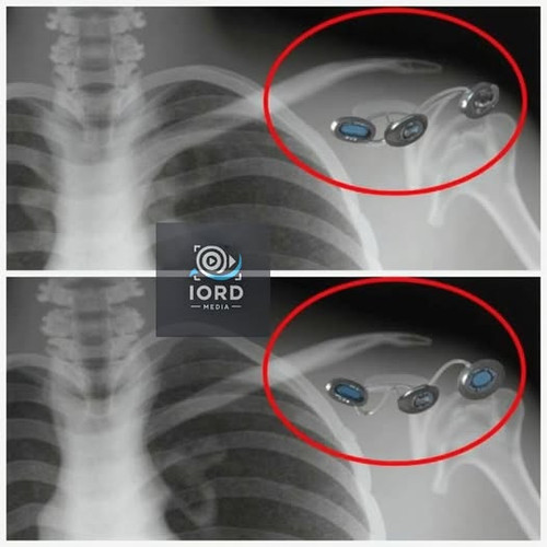 490822296 122171404784323385 4661751969138945131 n.jpg?stp=dst jpg p526x296 tt6& nc cat=111&ccb=1 7&.jpg