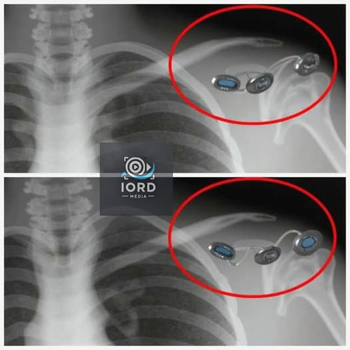 490822296 122171404784323385 4661751969138945131 n.jpg?stp=dst jpg p526x296 tt6& nc cat=111&ccb=1 7&.jpg