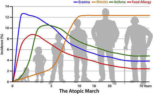 allergies2507.jpg