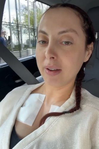 susan sarandons daughter eva amurri undergoes plastic surgery 680fd8f61497d png 700.jpg