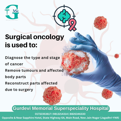 Bladder Cancer Treatment in Yamunanagar for Fast and Safe Recovery.jpg