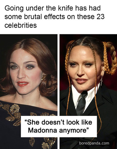 meme plastic surgery2.jpg