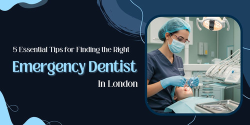 5 Essential Tips for Finding the Right Emergency Dentist in London.jpg