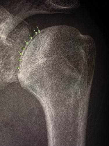 Grh91J7W0AANGF4.jpg