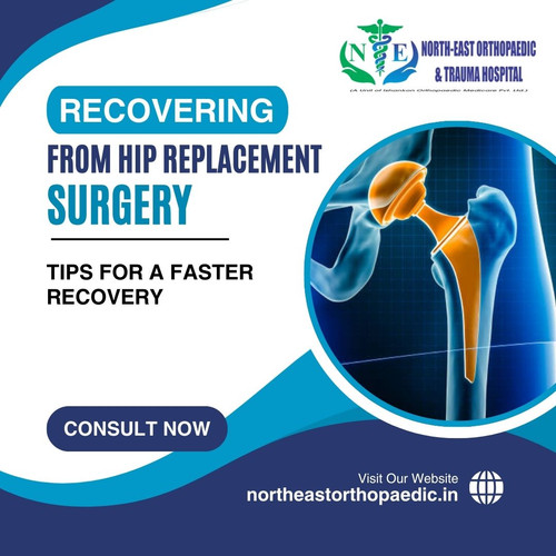 Recovering from Hip Replacement Surgery: Tips for a Faster Recovery.jpg