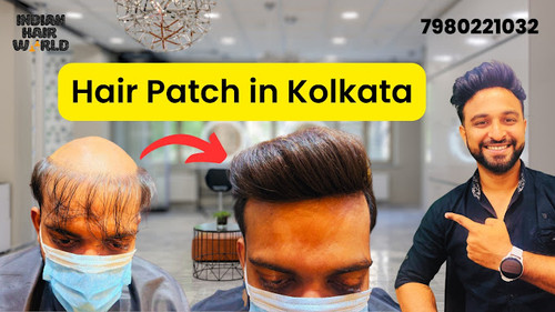 Best Hair Patch in Kolkata | Indian Hair World Salt Lake.jpg