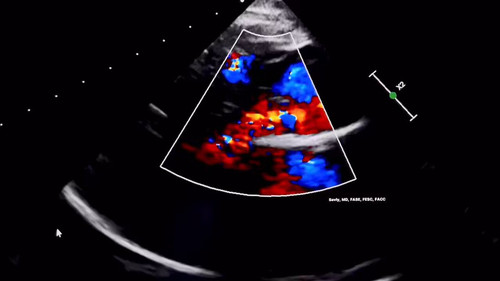 jbPX8G2bh3I LgPW.jpg