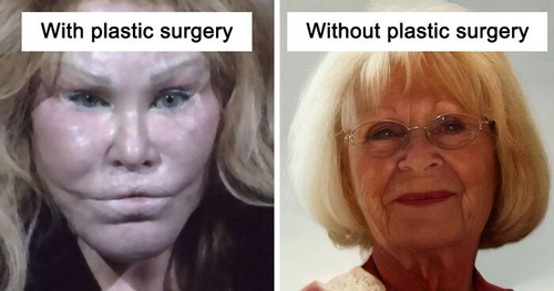 celebrities if they didnt have plastic surgery ai edits hidreley fb48 png 700.jpg