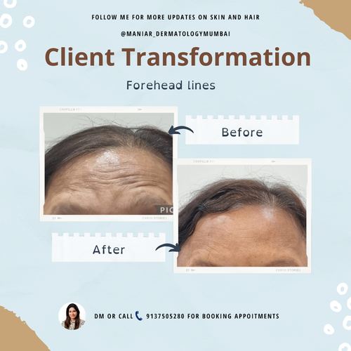 Hair Specialist in Chembur for Hair Fall and Scalp Treatments - Dr. Avani Maniar.png