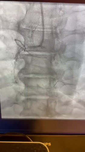 qxN4Y9KhK7B9y7pF.jpg