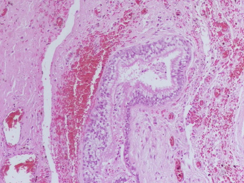 GqcUMieX0AANBB3.jpg