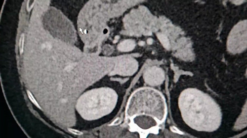 TMN54wK1EMzASfLO.jpg