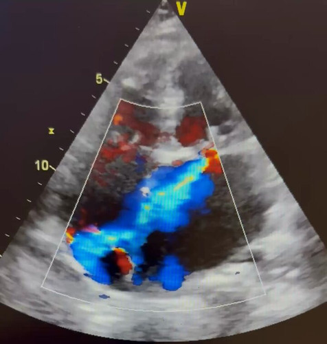 1t9HOvwUPA2 fNCd.jpg