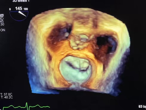 4QSwrF 8eLOL1Bed.jpg