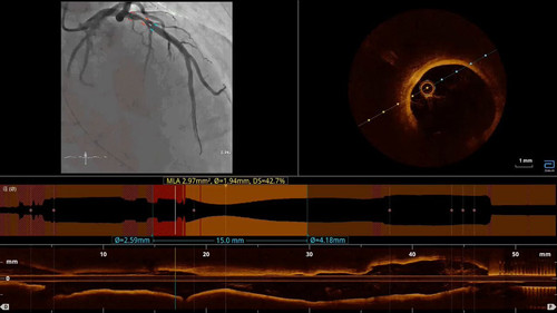 0g2 zk5mgPyFfo1U.jpg