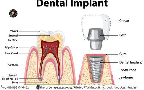 Best dental clinic in indira nagar.jpg