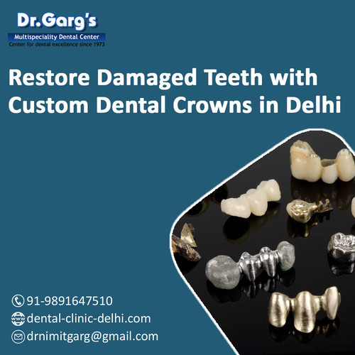 Restore Damaged Teeth with Custom Dental Crowns in Delhi.jpg