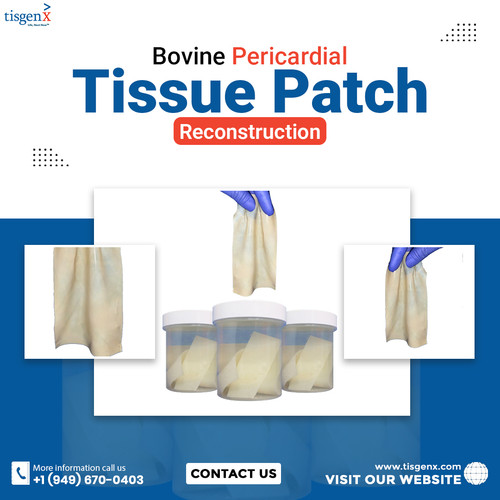 Bovine Pericardial Tissue Patch Reconstruction.jpg
