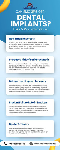 Can Smokers Get Dental Implants? Risks & Considerations.jpg