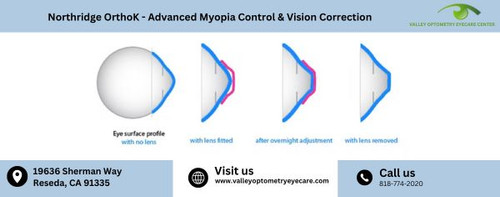 Northridge OrthoK Advanced Myopia Control & Vision Correction(1).jpg