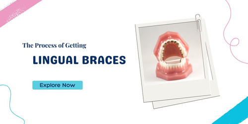 THE PROCESS OF GETTING LINGUAL BRACES.jpg