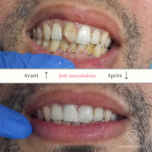 Beige and Blue Minimalist Beauty Skincare Before After Collage Instagram Post.png