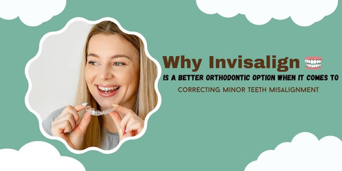 Why Invisalign is a Better Orthodontic Option When It Comes to Correcting Minor Teeth Misalignment.jpg