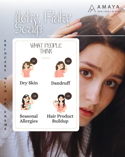 Best Hair Loss Treatment In Hyderabad.jpg